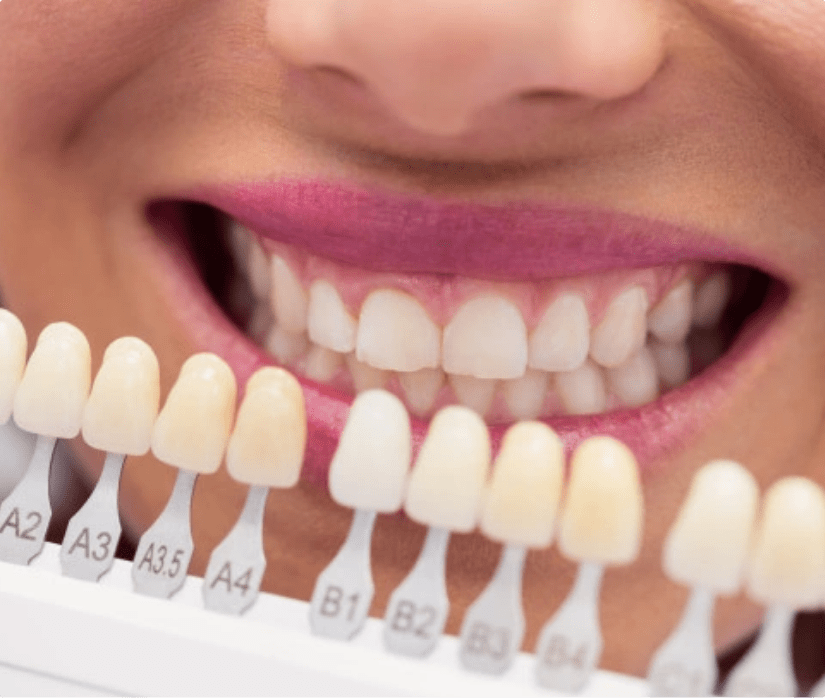 Dental care